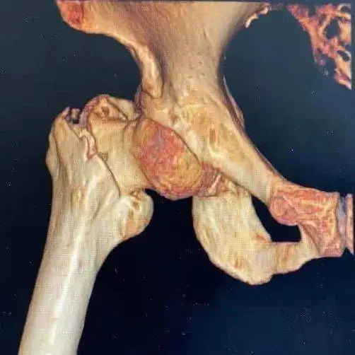 u=705150291,2179010975&fm=253&fmt=auto&app=138&a