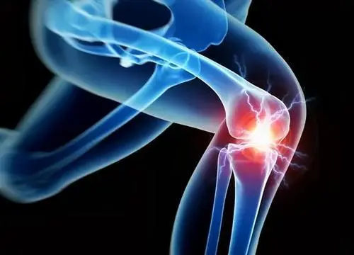 33,3417601504&fm=253&fmt=auto&app=138&f=JPEG