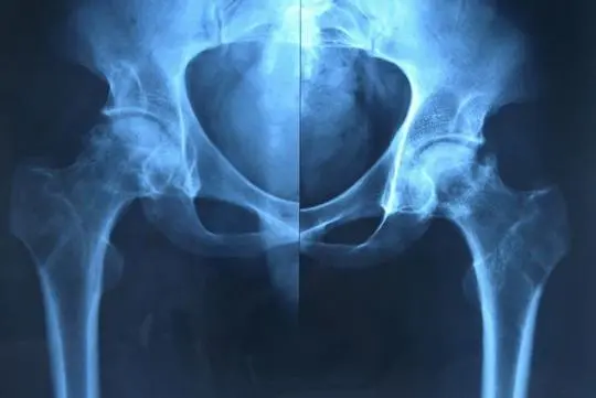 u=2389706989,1036436662&fm=253&fmt=auto&app=120&